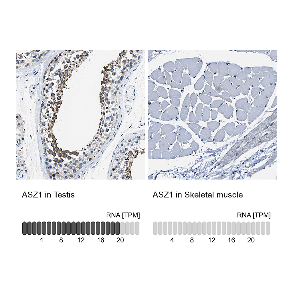 Atlas Antibodies Anti-ASZ1 Antibody