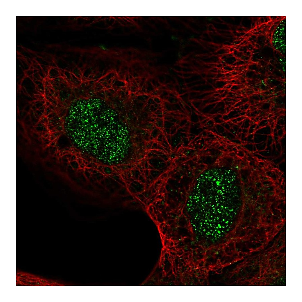 Atlas Antibodies Anti-ASXL2 Antibody