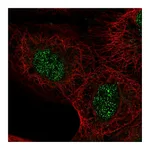 Atlas Antibodies Anti-ASXL2 Antibody