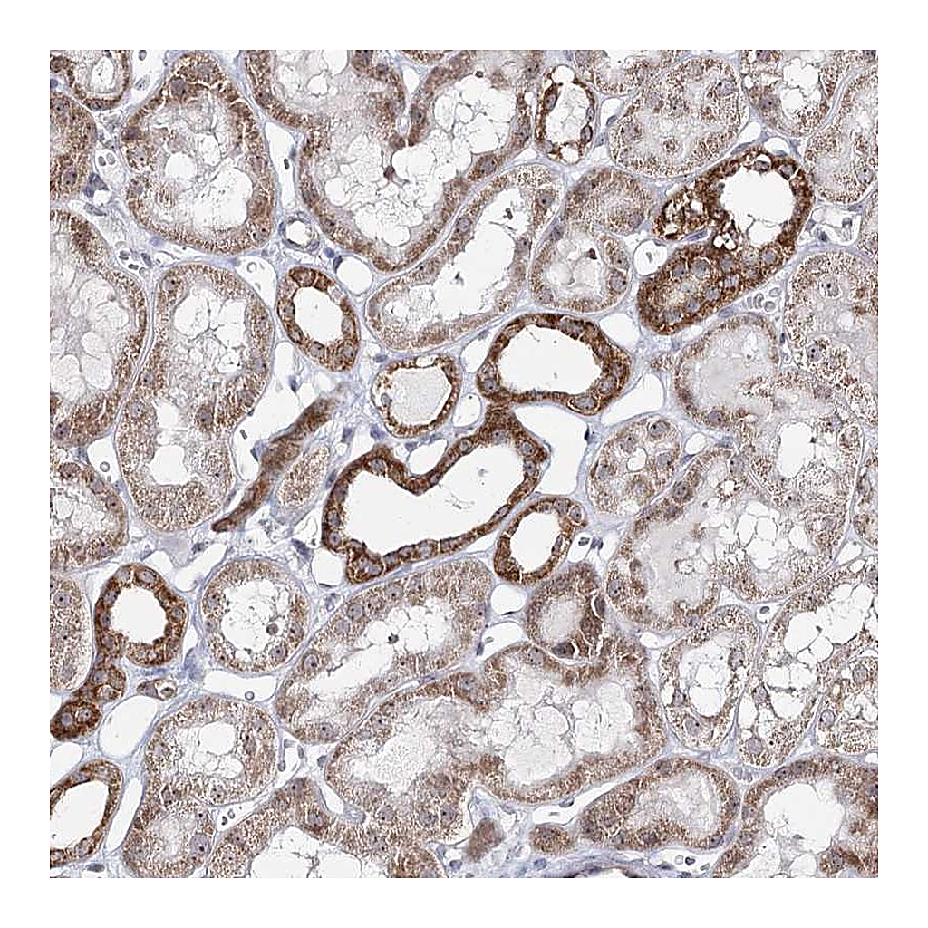Atlas Antibodies Anti-ATAD1 Antibody