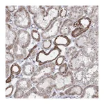 Atlas Antibodies Anti-ATAD1 Antibody