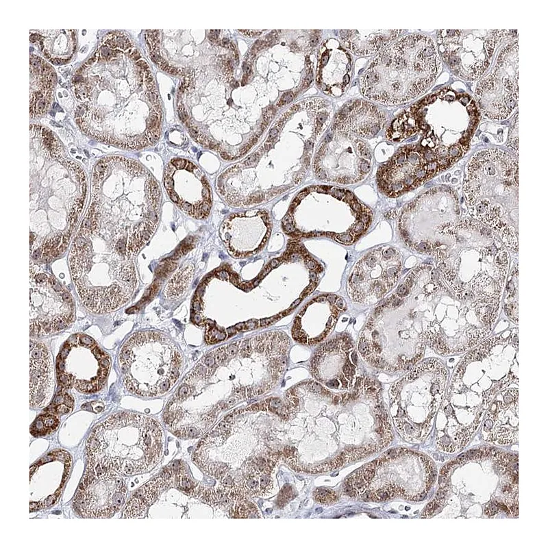 Atlas Antibodies Anti-ATAD1 Antibody