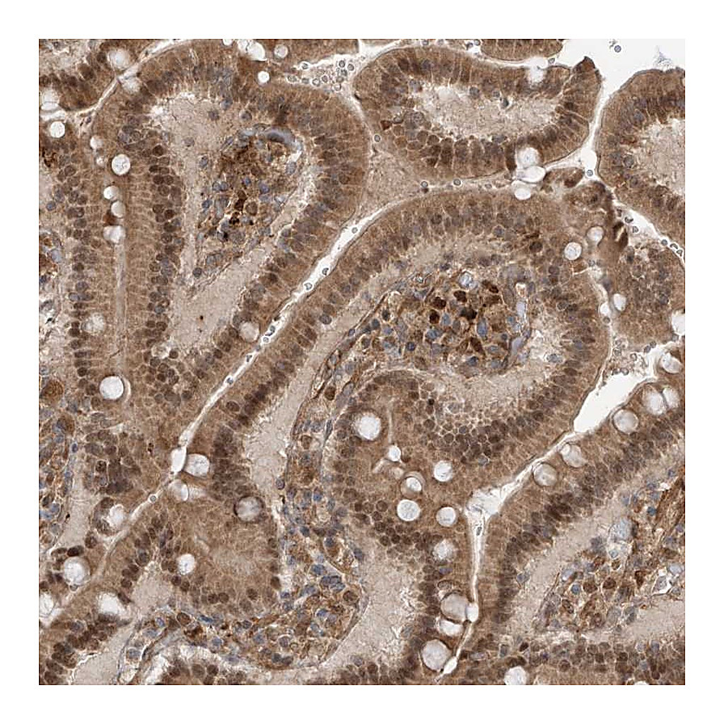 Atlas Antibodies Anti-ATAD2B Antibody