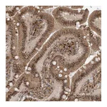 Atlas Antibodies Anti-ATAD2B Antibody