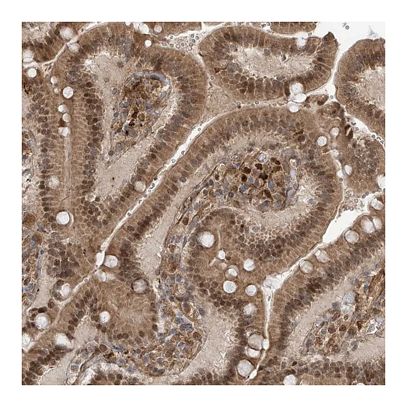 Atlas Antibodies Anti-ATAD2B Antibody