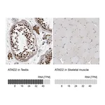 Atlas Antibodies Anti-ATAD2 Antibody