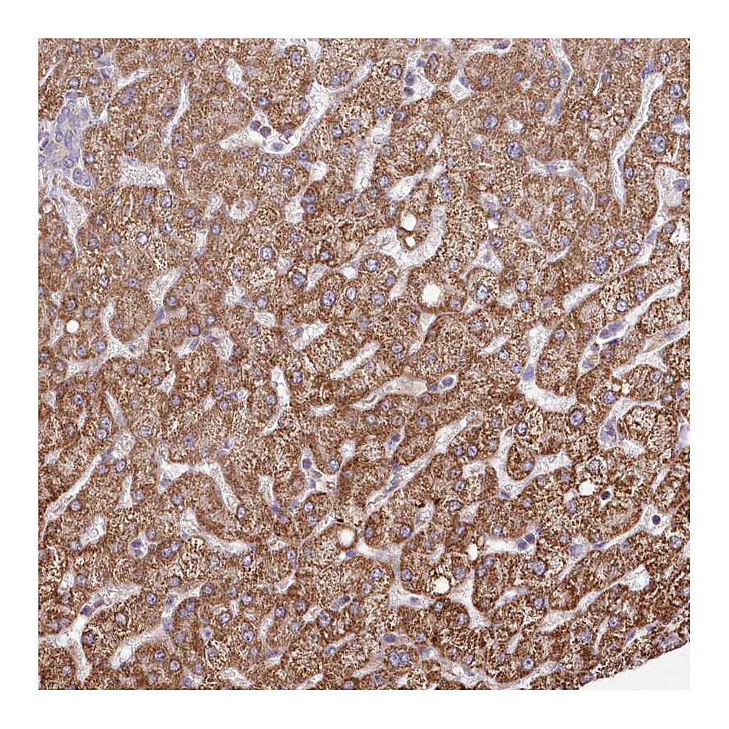 Atlas Antibodies Anti-ATE1 Antibody