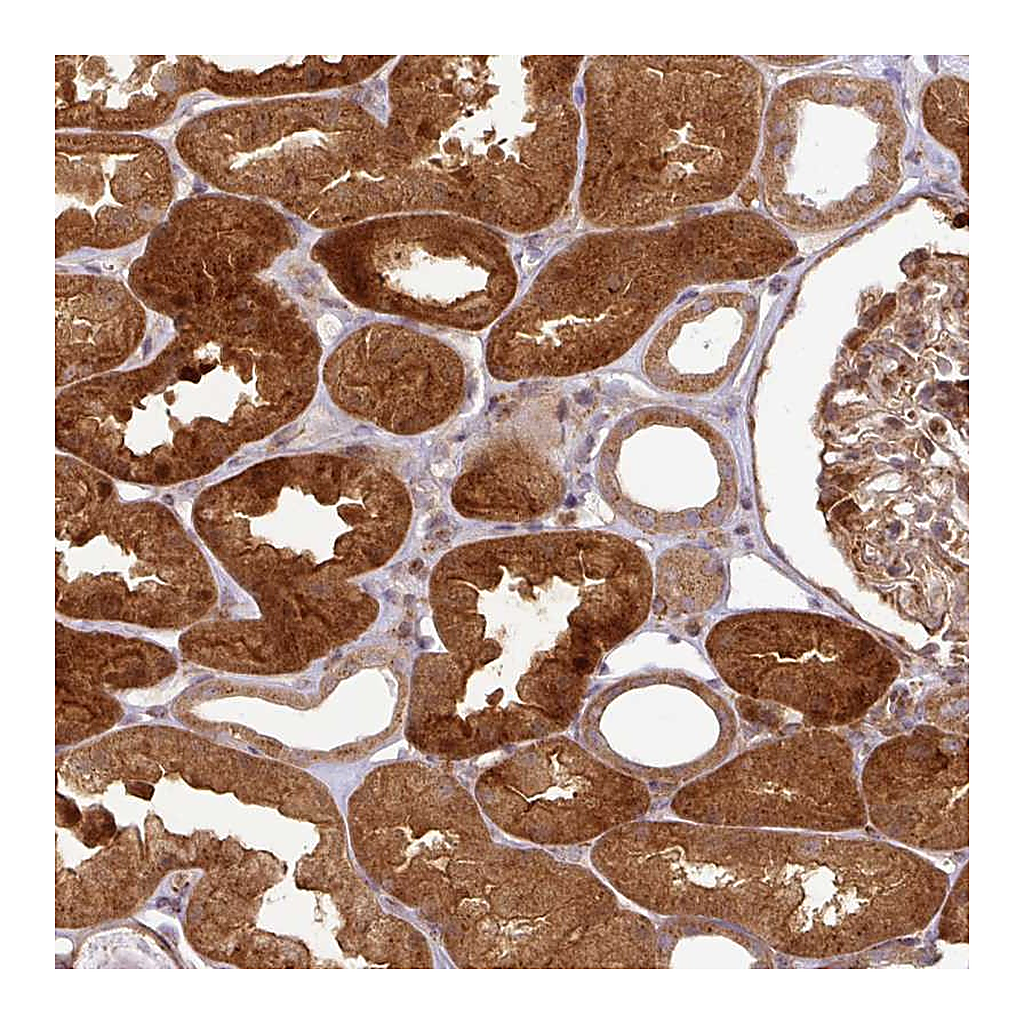 Atlas Antibodies Anti-ATAT1 Antibody