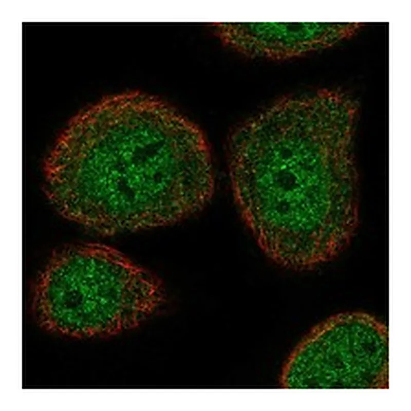 Atlas Antibodies Anti-ATAD5 Antibody