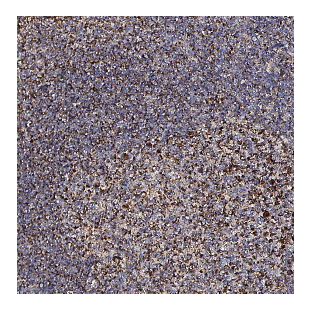 Atlas Antibodies Anti-ATAD3B Antibody