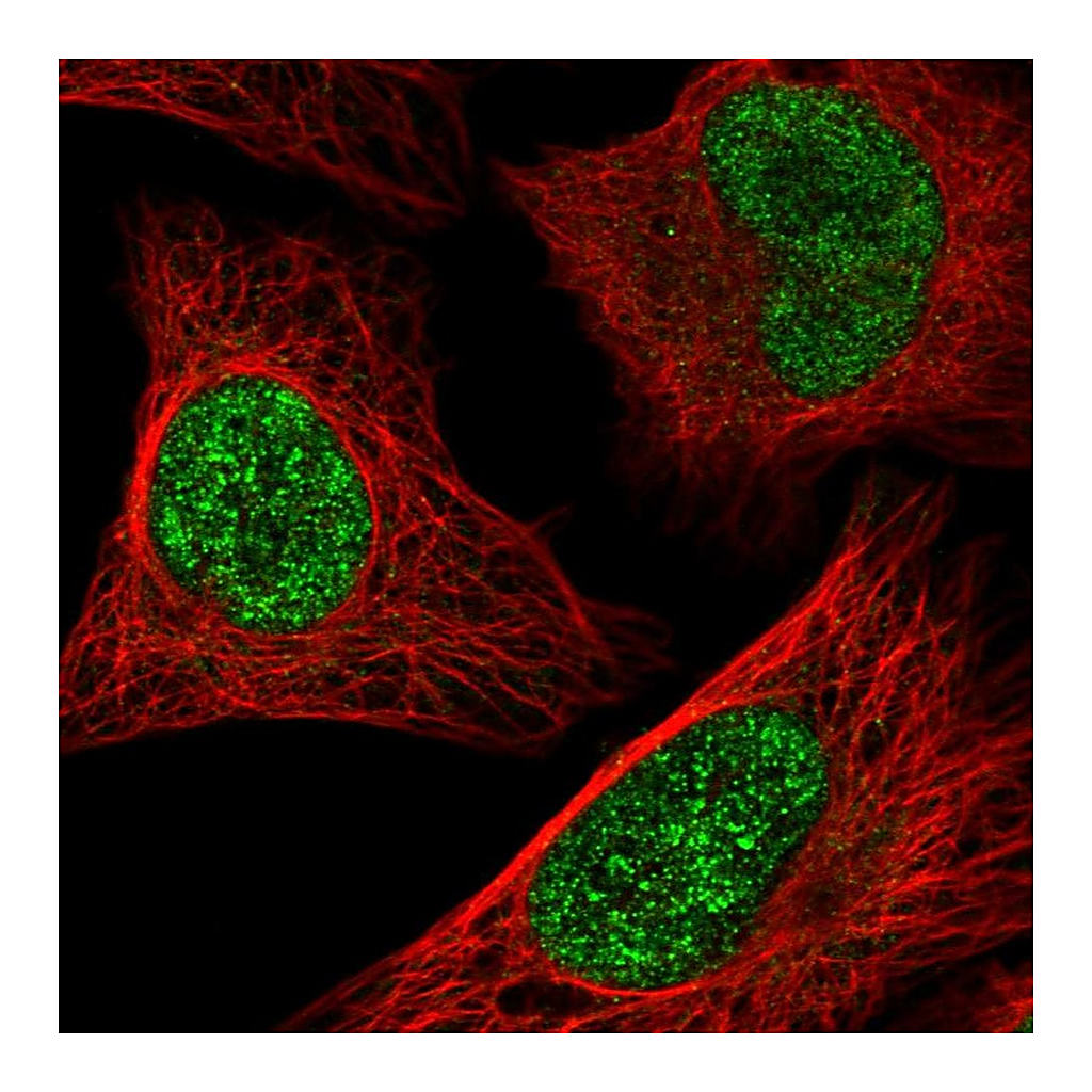 Atlas Antibodies Anti-ATF1 Antibody