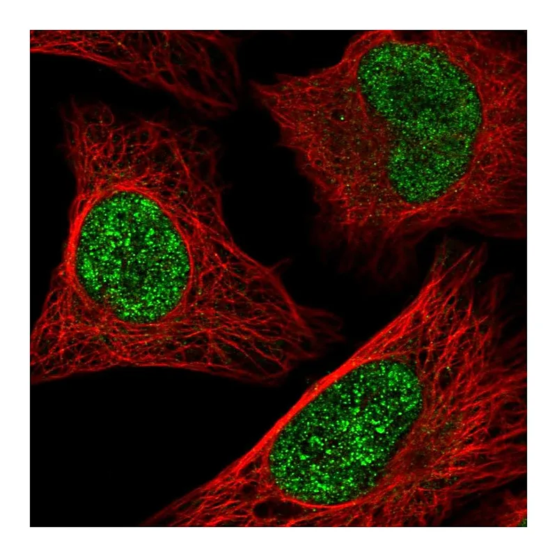 Atlas Antibodies Anti-ATF1 Antibody