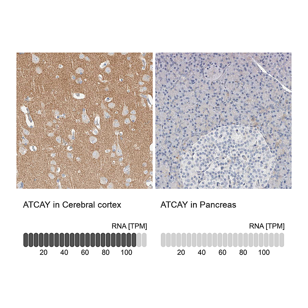 Atlas Antibodies Anti-ATCAY Antibody
