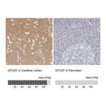 Atlas Antibodies Anti-ATCAY Antibody
