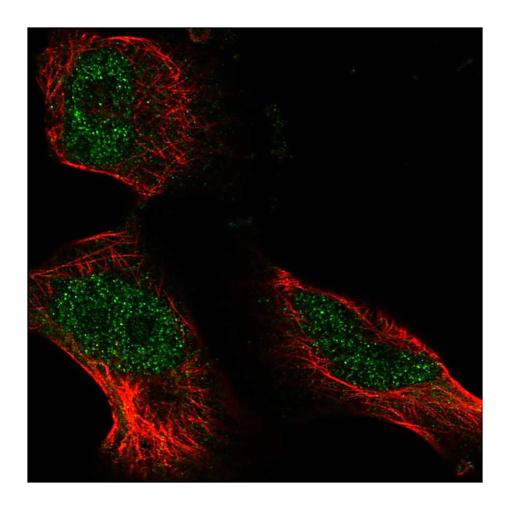 Atlas Antibodies Anti-ATE1 Antibody