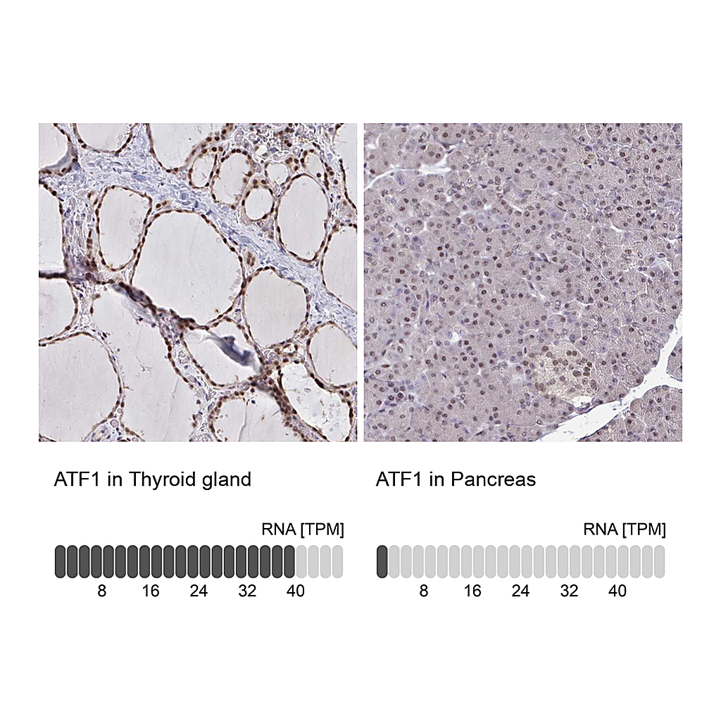 Atlas Antibodies Anti-ATF1 Antibody