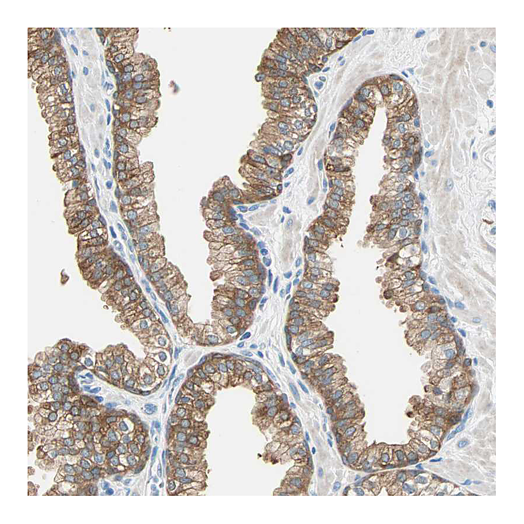 Atlas Antibodies Anti-ATF6 Antibody