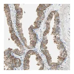 Atlas Antibodies Anti-ATF6 Antibody