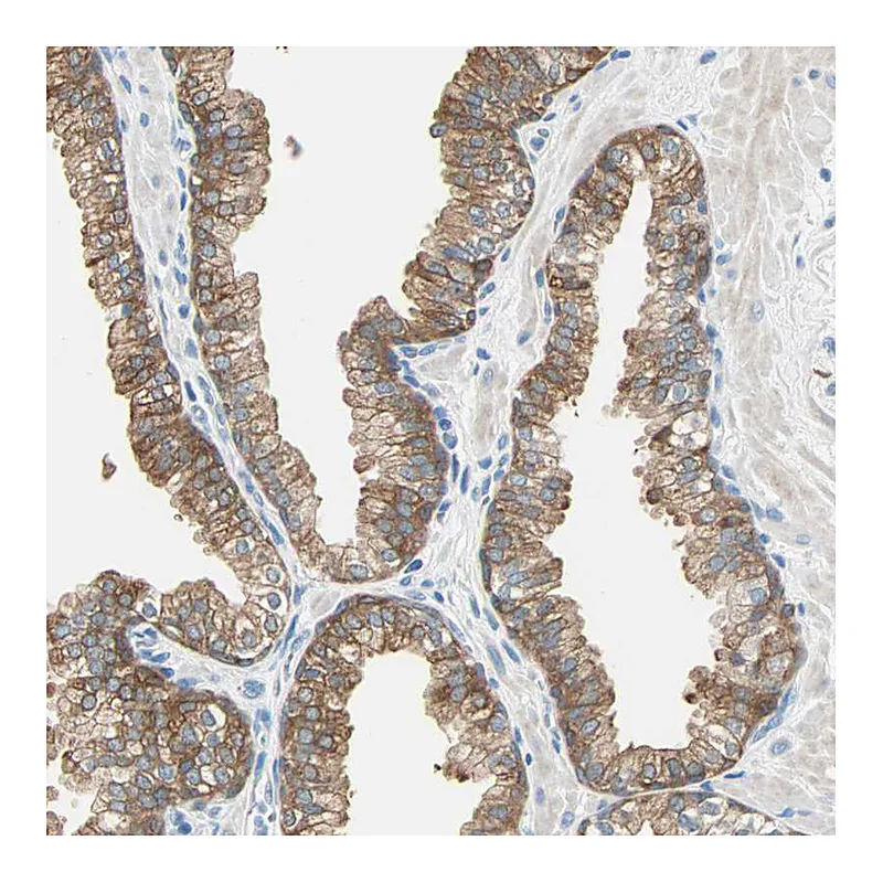 Atlas Antibodies Anti-ATF6 Antibody