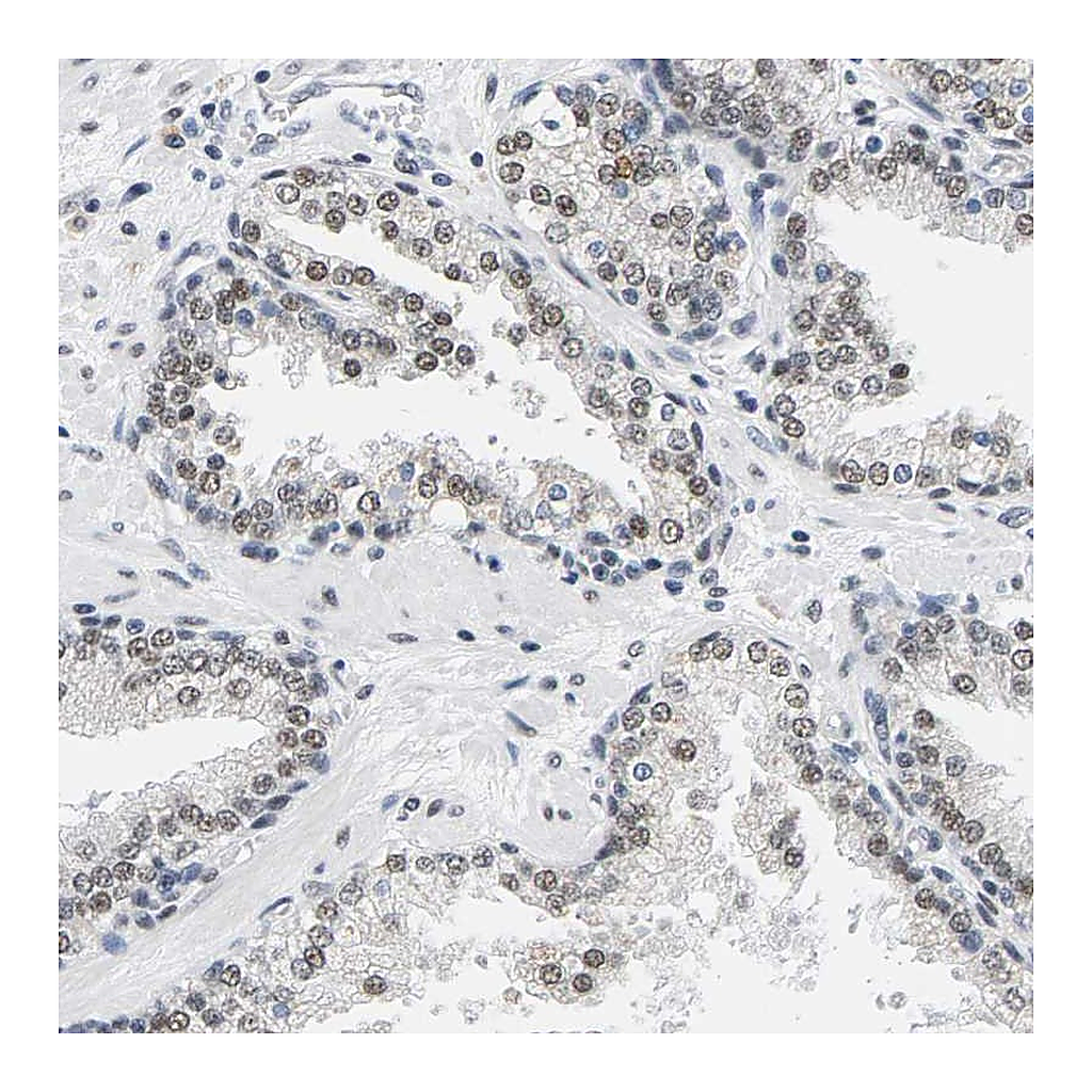 Atlas Antibodies Anti-ATF2 Antibody