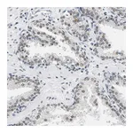 Atlas Antibodies Anti-ATF2 Antibody