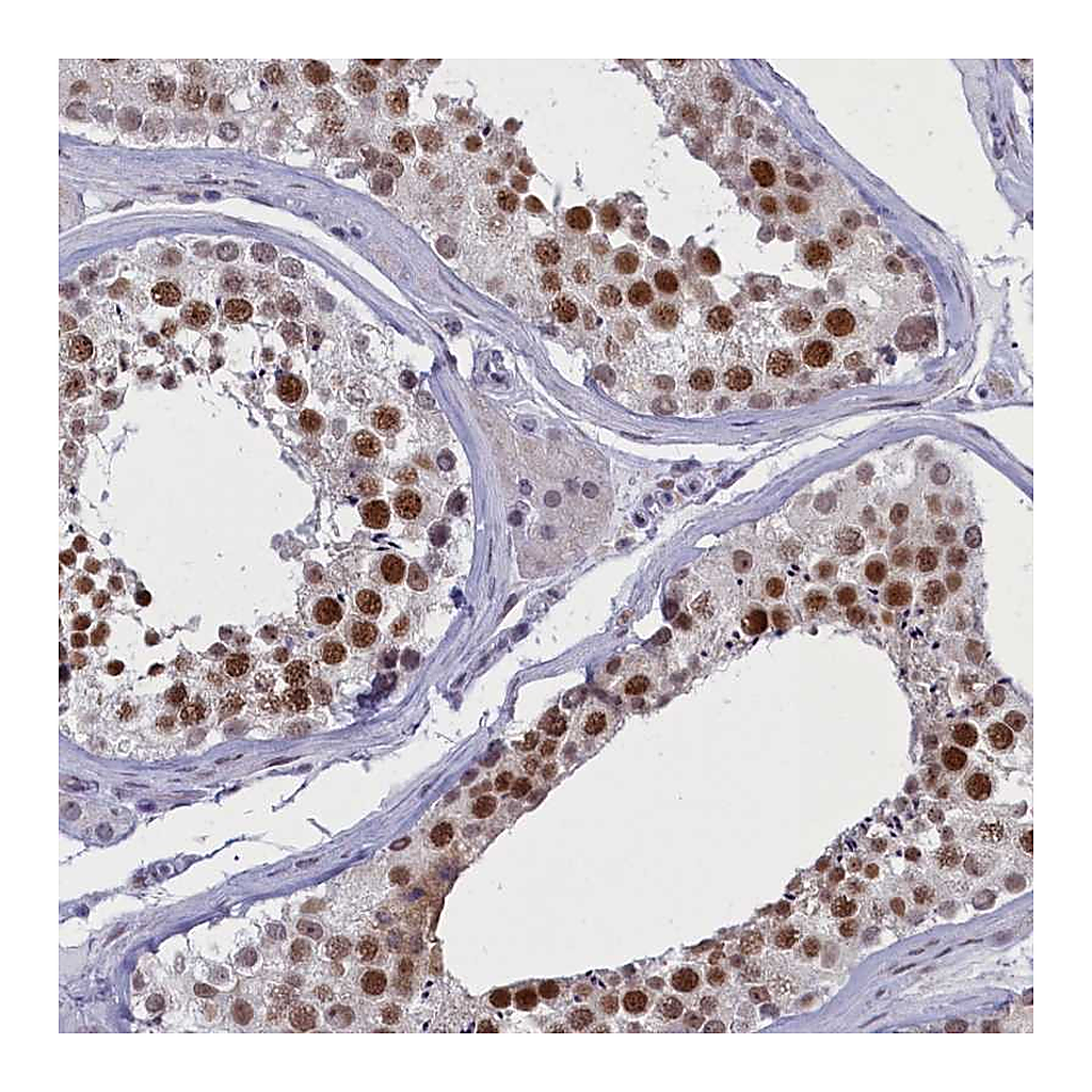Atlas Antibodies Anti-ATF7IP2 Antibody