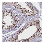 Atlas Antibodies Anti-ATF7IP2 Antibody