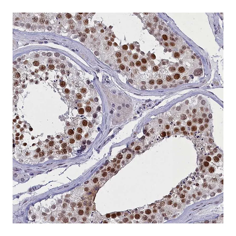 Atlas Antibodies Anti-ATF7IP2 Antibody