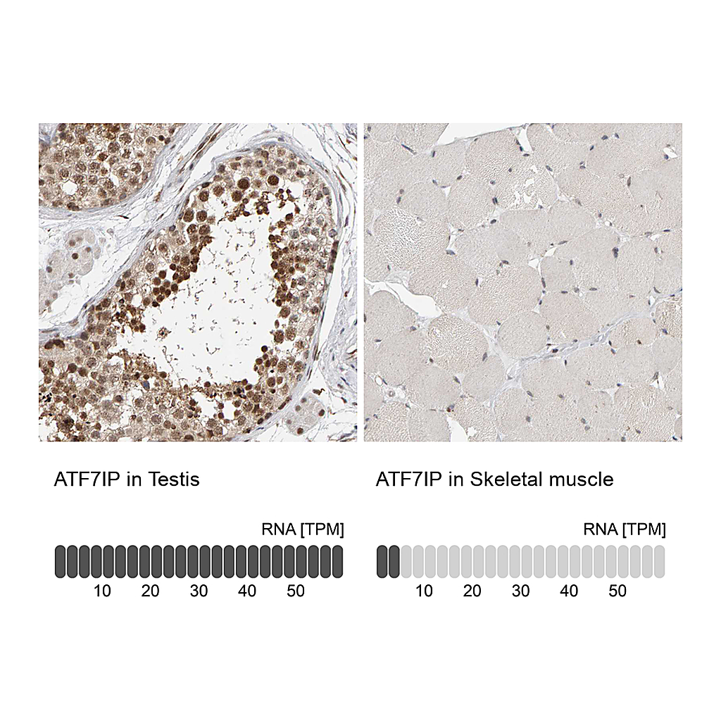 Atlas Antibodies Anti-ATF7IP Antibody