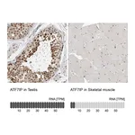 Atlas Antibodies Anti-ATF7IP Antibody