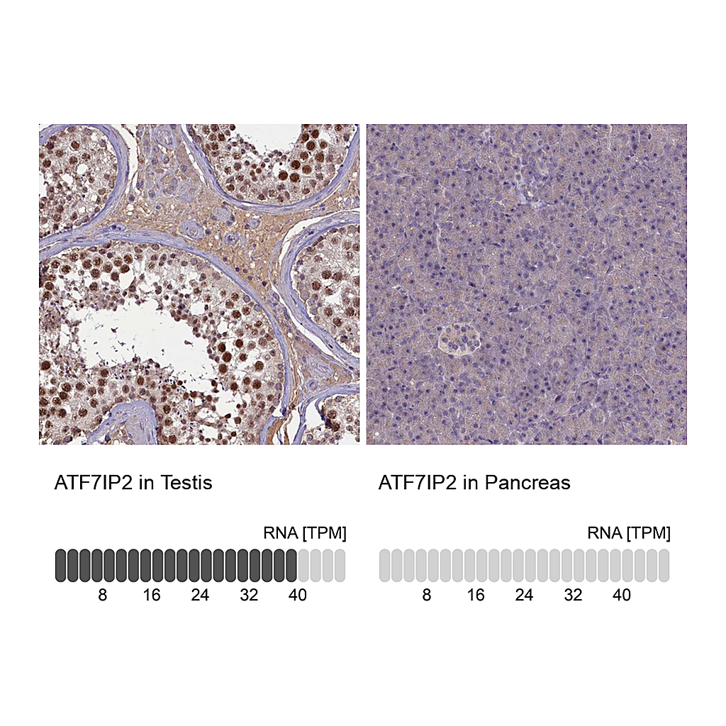 Atlas Antibodies Anti-ATF7IP2 Antibody