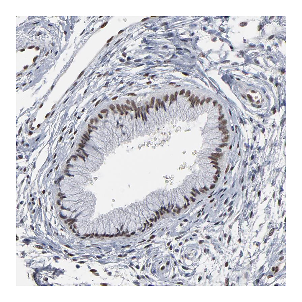 Atlas Antibodies Anti-ATF7 Antibody