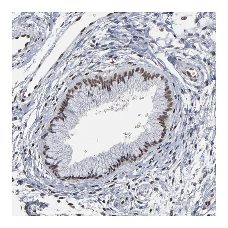 Atlas Antibodies Anti-ATF7 Antibody