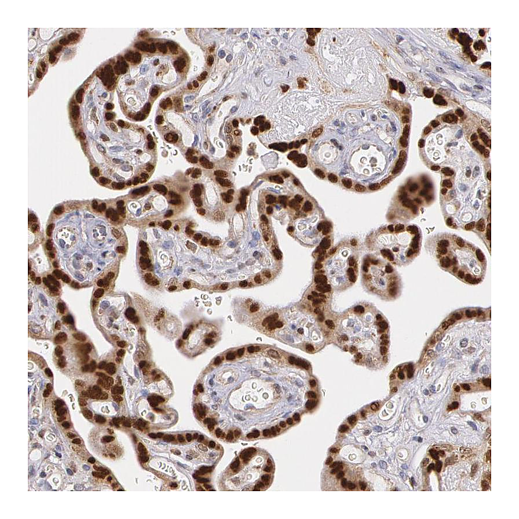 Atlas Antibodies Anti-ATF3 Antibody