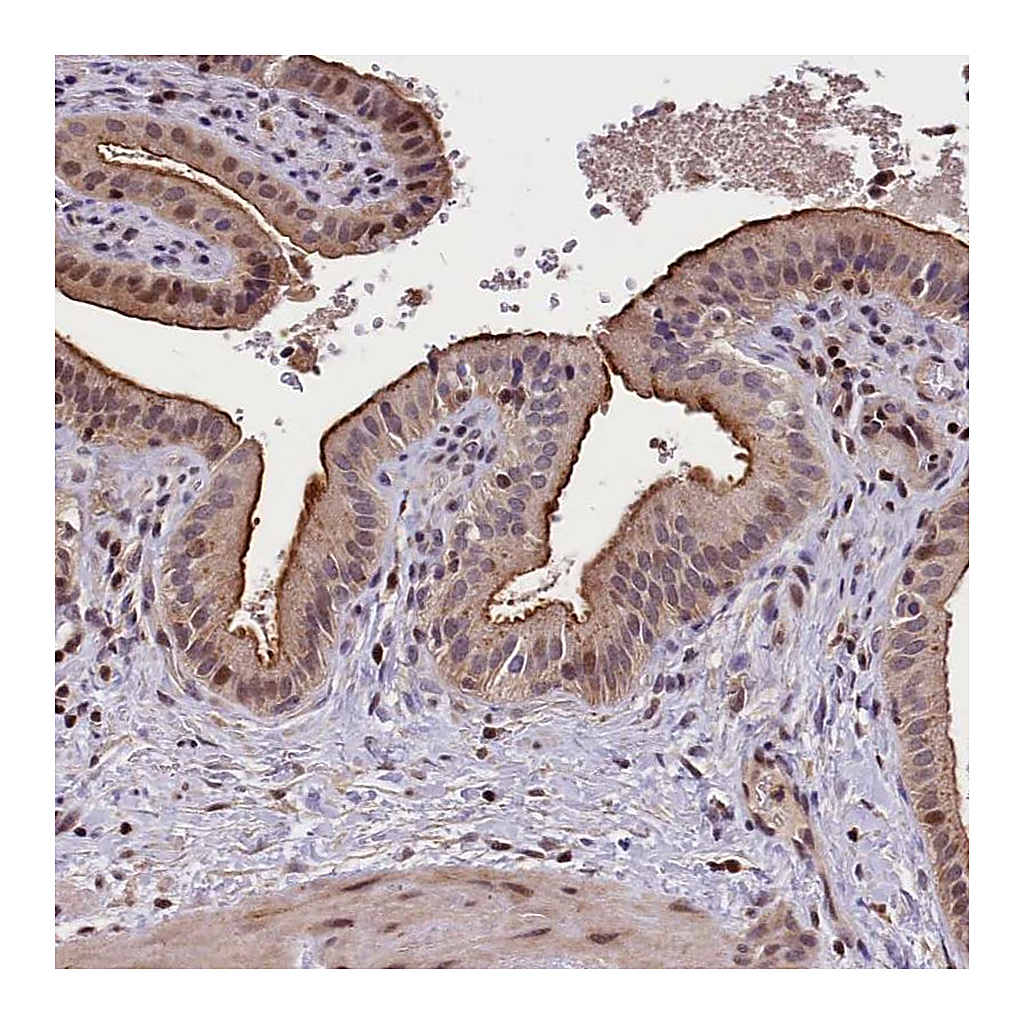 Atlas Antibodies Anti-ATG101 Antibody