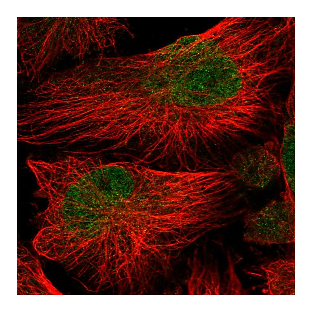 Atlas Antibodies Anti-ATG16L2 Antibody