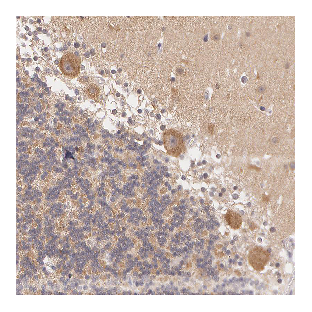 Atlas Antibodies Anti-ATG2B Antibody
