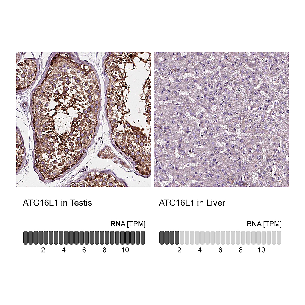Atlas Antibodies Anti-ATG16L1 Antibody