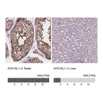 Atlas Antibodies Anti-ATG16L1 Antibody