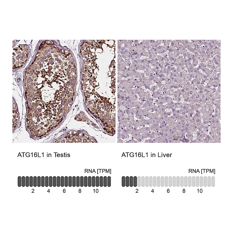 Atlas Antibodies Anti-ATG16L1 Antibody