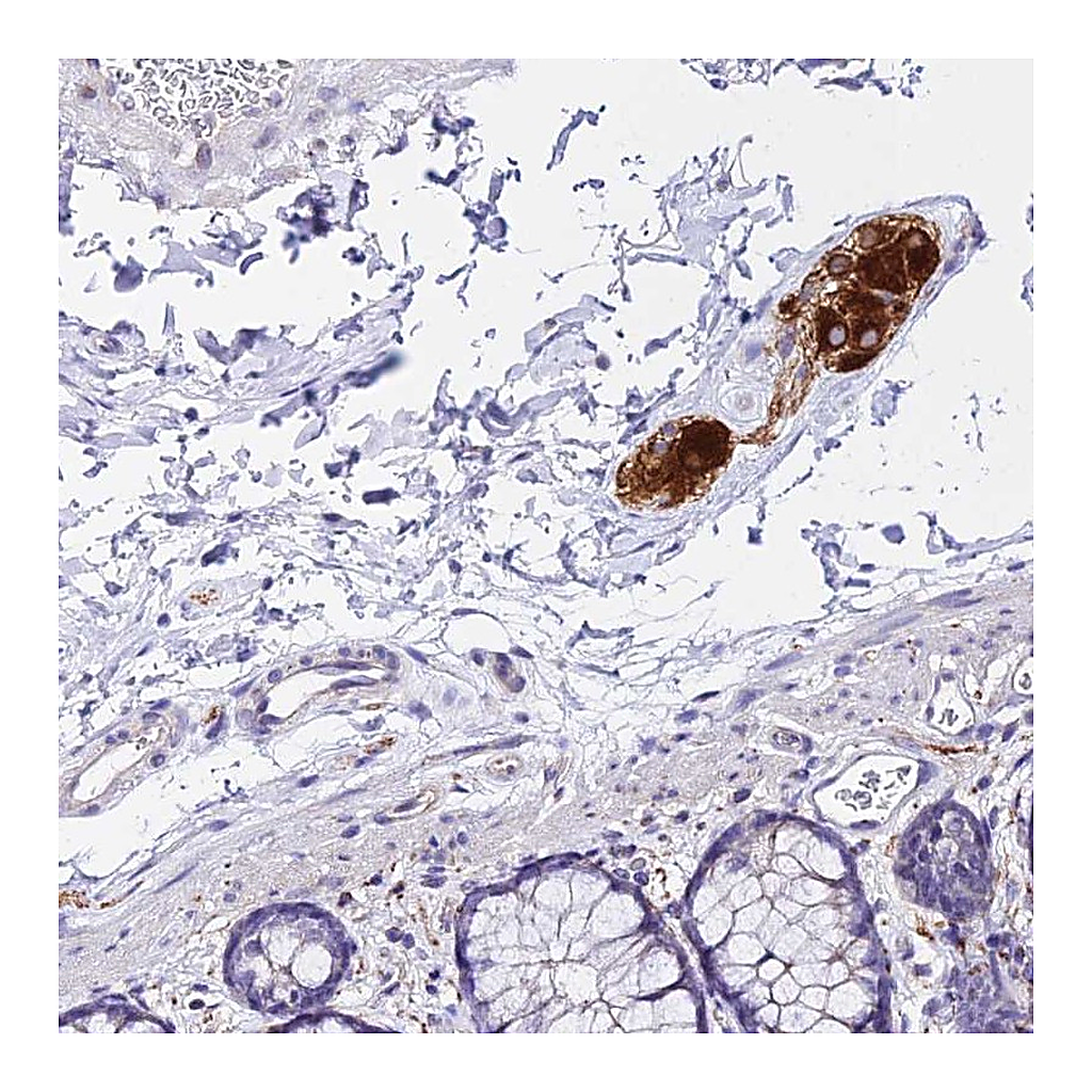 Atlas Antibodies Anti-ATG16L2 Antibody