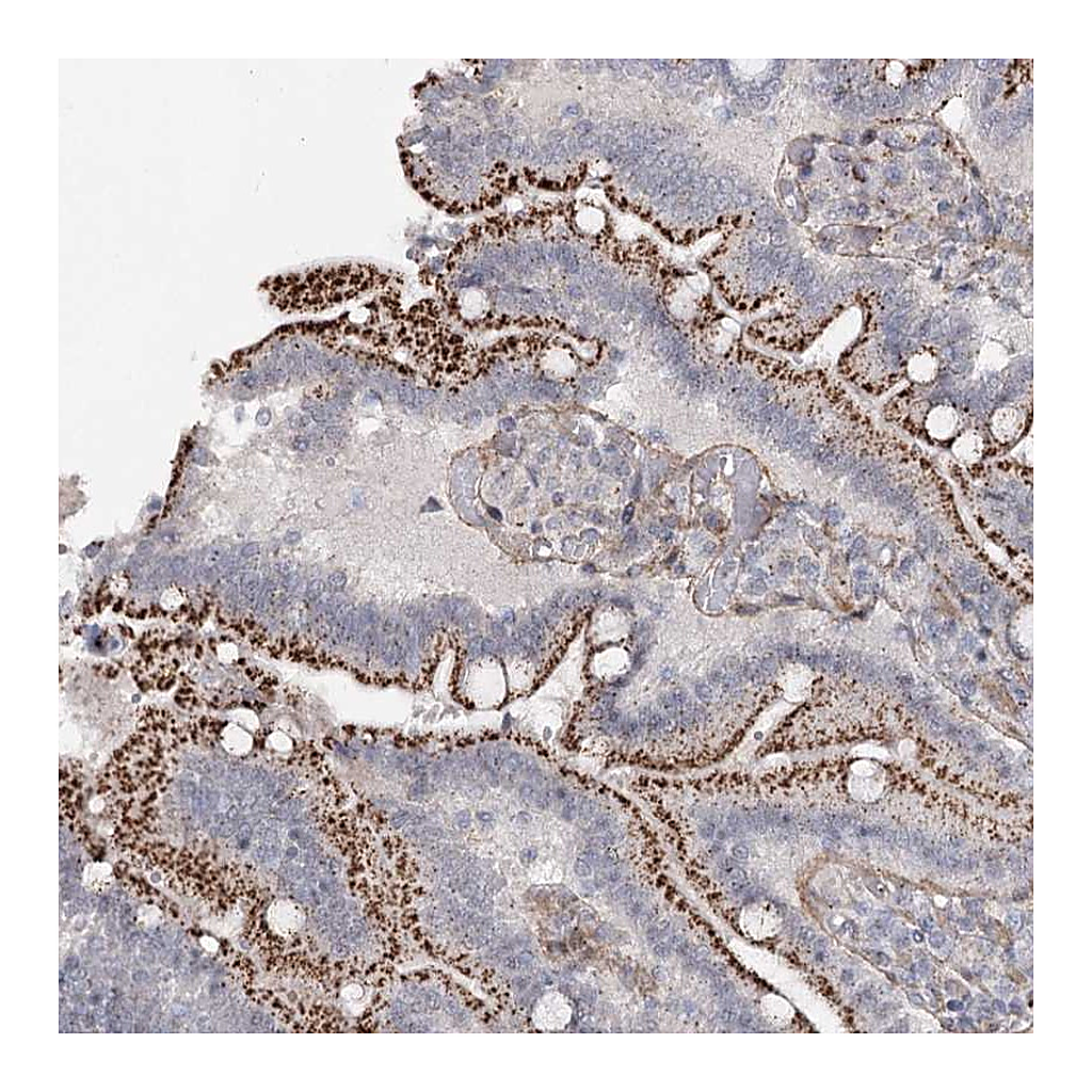 Atlas Antibodies Anti-ATL2 Antibody
