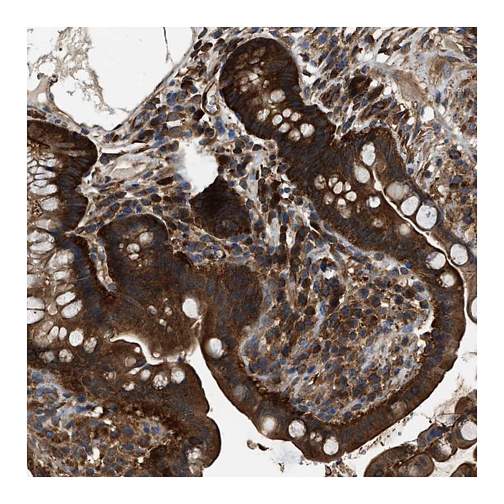 Atlas Antibodies Anti-ATIC Antibody