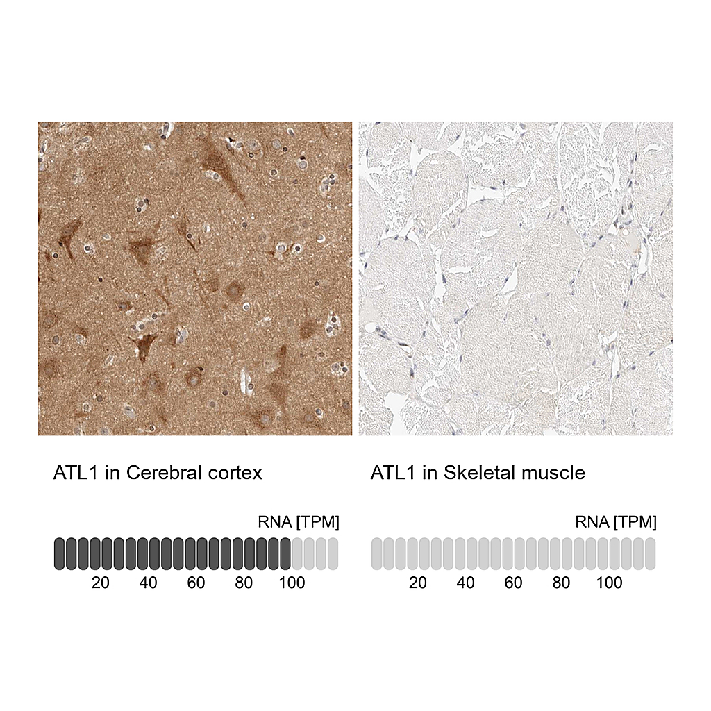 Atlas Antibodies Anti-ATL1 Antibody