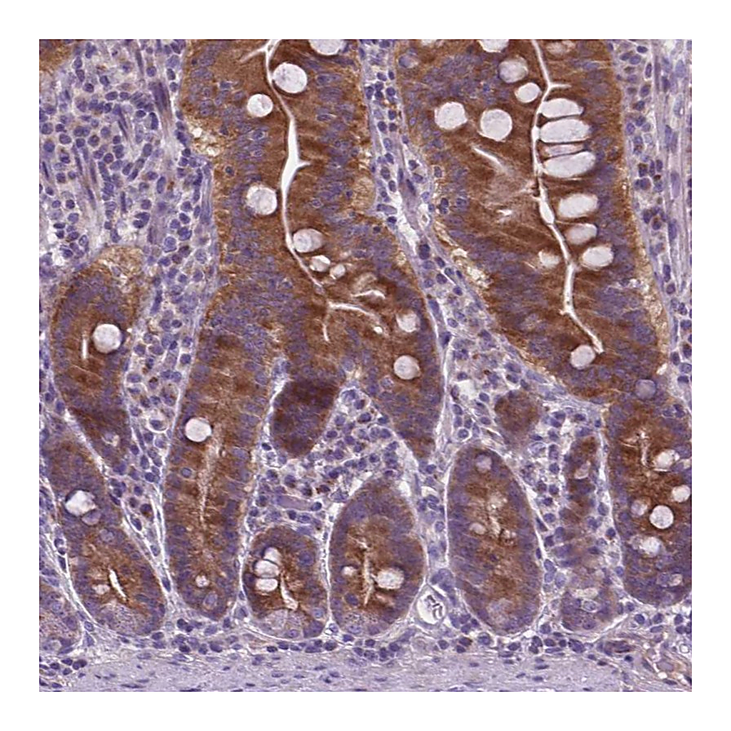 Atlas Antibodies Anti-ATG4D Antibody