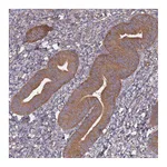 Atlas Antibodies Anti-ATG5 Antibody