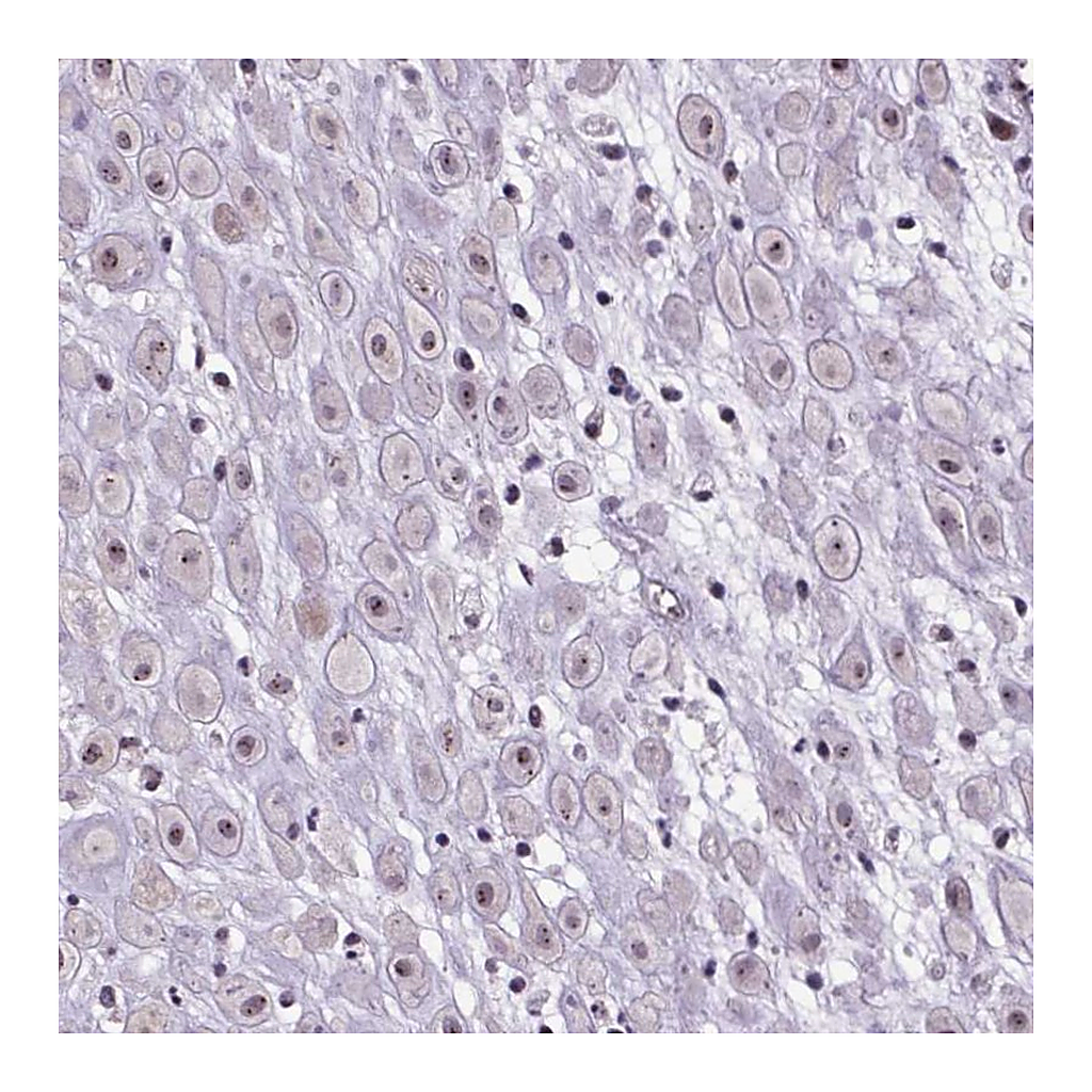 Atlas Antibodies Anti-ATMIN Antibody