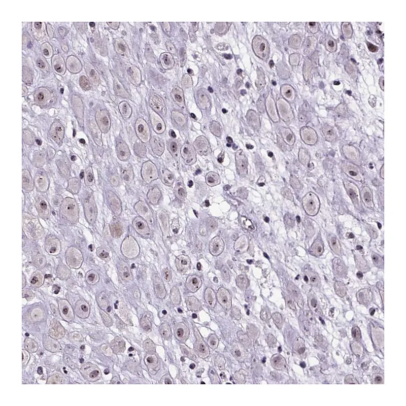 Atlas Antibodies Anti-ATMIN Antibody