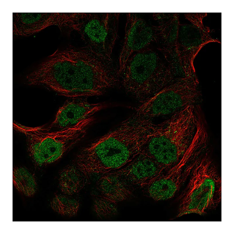 Atlas Antibodies Anti-ATM Antibody