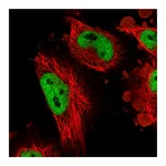 Atlas Antibodies Anti-ATN1 Antibody